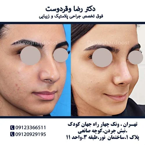 پزشک بهترین پزشک بینی استخوانی