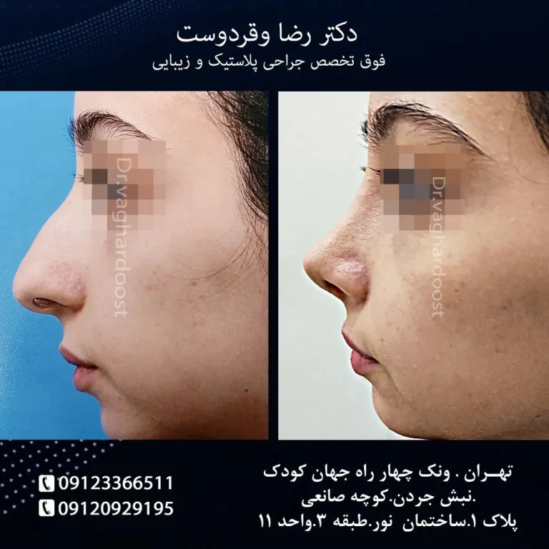  بهترین پزشک بینی استخوانی