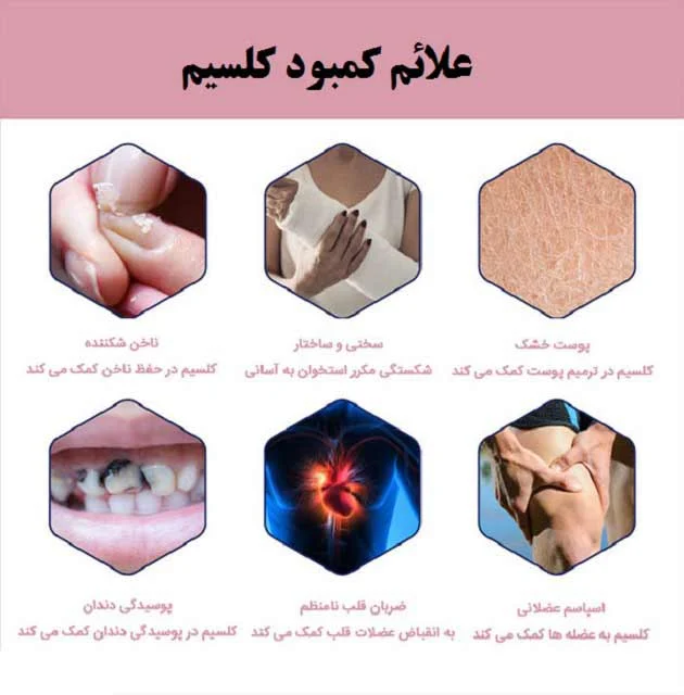 بیماری کمبود کلسیم در بدن انسان باعث ایجاد چه بیماری میشود؟