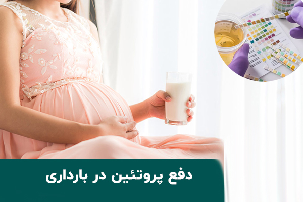 برای جلوگیری از دفع پروتئین در بارداری چه باید کرد؟