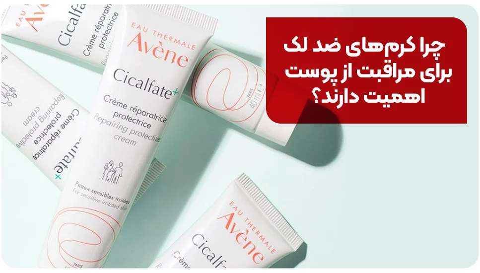 چرا کرمهای ضد لک برای مراقبت از پوست اهمیت دارند؟