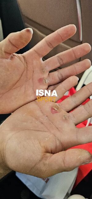 علت غیبت قهرمان جهان در اردوی تیم ملی وزنهبرداری