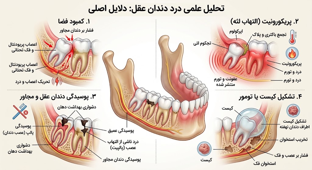 دندانپزشکی | ایمپلنت دندان عقل نشانه چیست